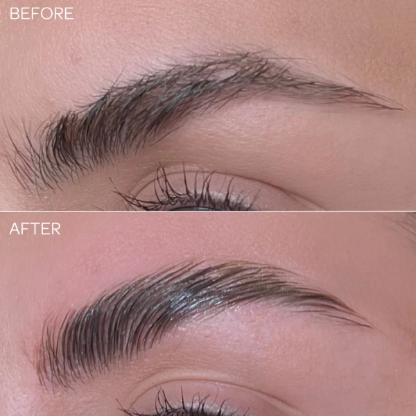 Before_After